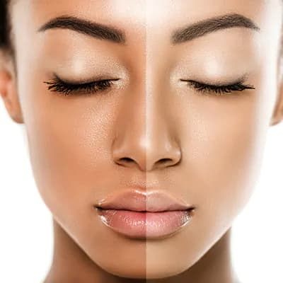 Budget-friendly Brightening, and Darkspots