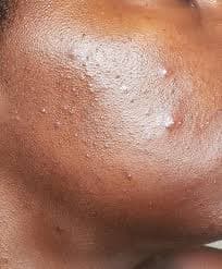 Textured skin