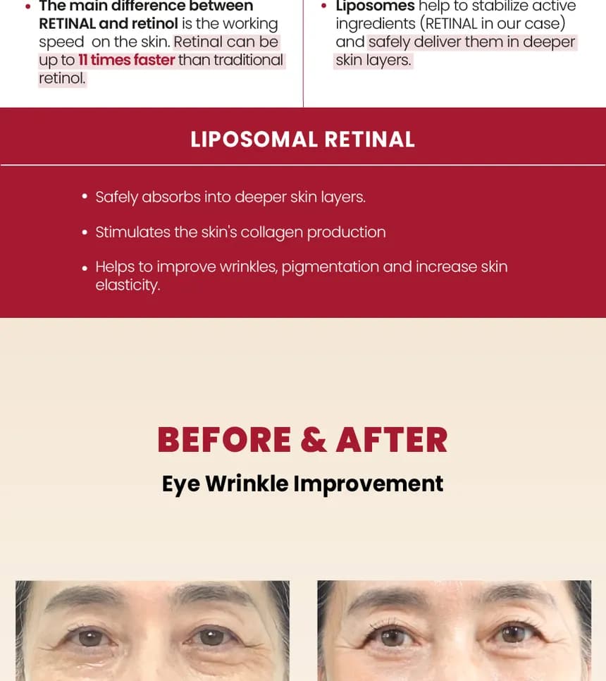 KSECRET - SEOUL 1988 Eye Cream : Retinal Liposome 4% + Fermented Bean detail 4