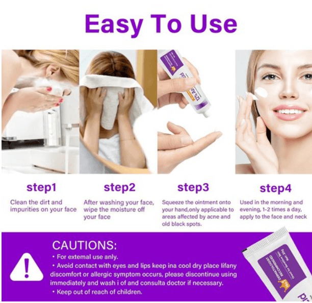 Azelaic Acid 15% Cream Soothing Acne detail 1
