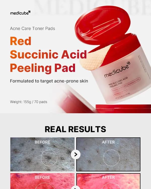 MediCube Red Succinic Acid Peeling Pad 70 sheets detail 1