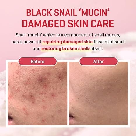 Some By Me Snail Trucica Miracle Repair Serum detail 4